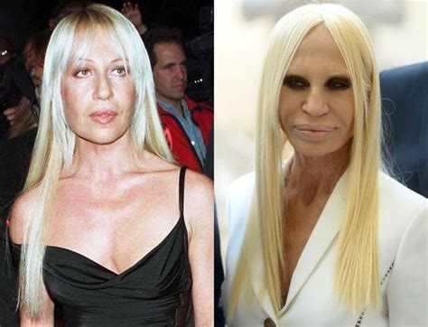 donatella versace before and after|Donatella Versace old pictures.